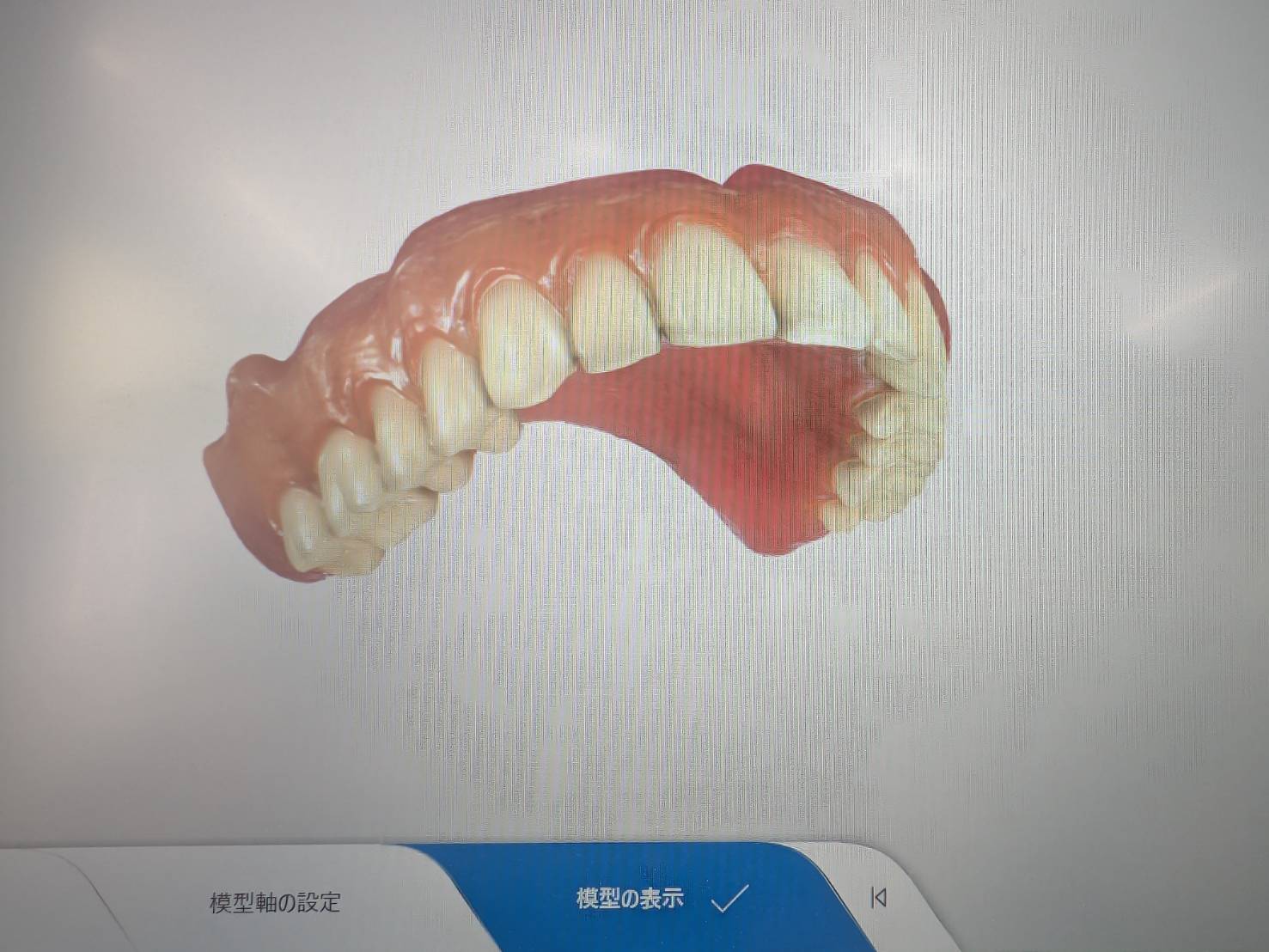 入れ歯製作の流れ